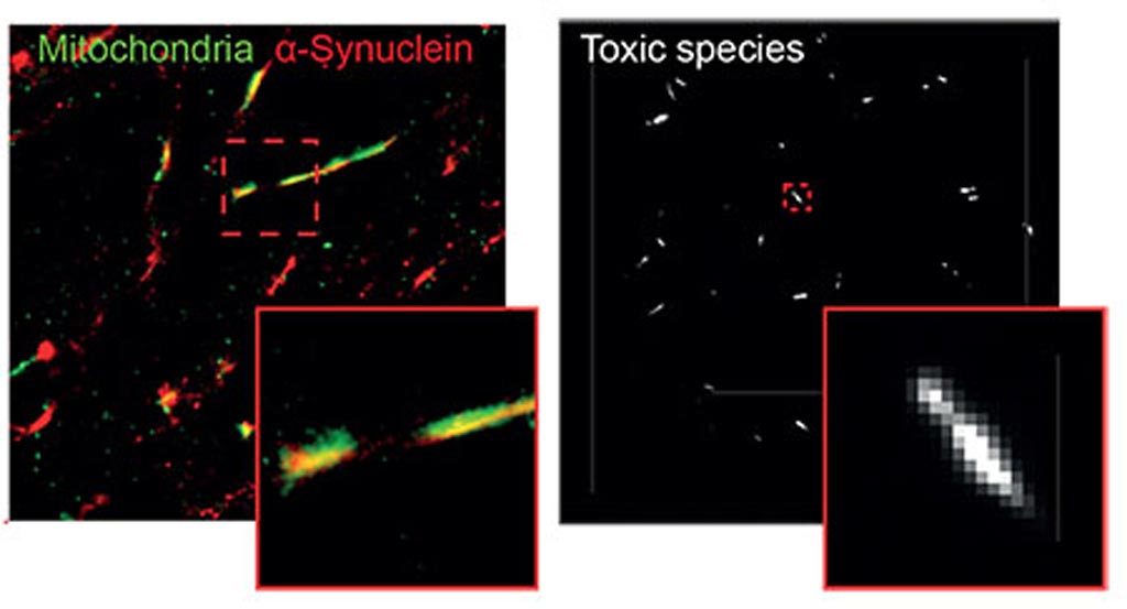 Image: Alpha-synuclein in mitochondria of neuron (left) and single molecule TIRF image of individual alpha-synuclein aggregates (right) (Photo courtesy of Mathew Horrocks).