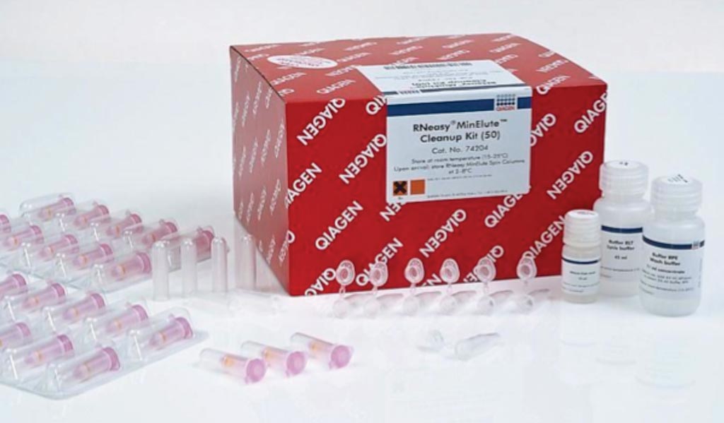 Image: The RNeasy MinElute cleanup kit (Photo courtesy of Qiagen).