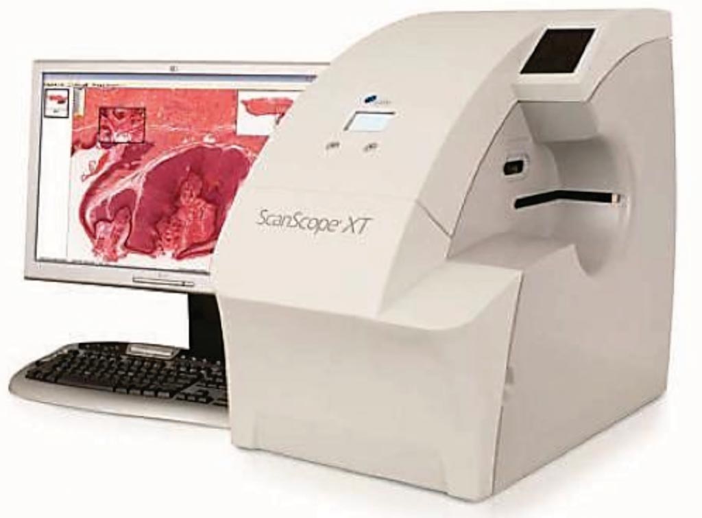 Image: The Aperio Scanscope XT whole-slide scanner (Photo courtesy of Leica Microsystems).