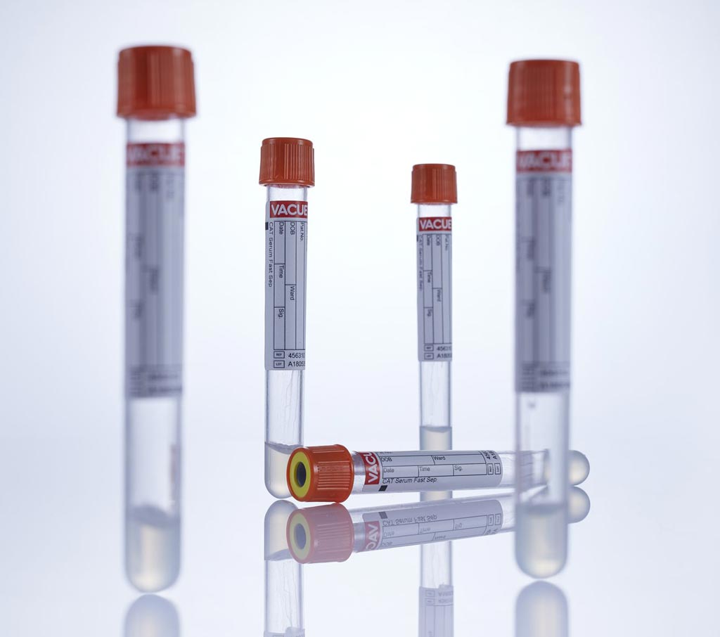 Image: The Vacuette Serum Fast Tubes, which offer a coagulation time of only five minutes (Photo courtesy of Greiner Bio-One).