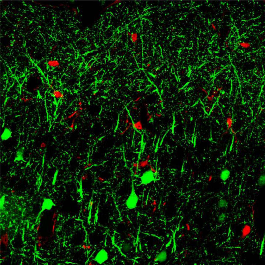 Image: MicroRNA 142, in green, shown in neurons in the brain. The molecule may represent a potential biomarker to diagnosis or predict Tau protein-linked dementia (Photo courtesy of Dr. Hui-Chen Lu, Indiana University).
