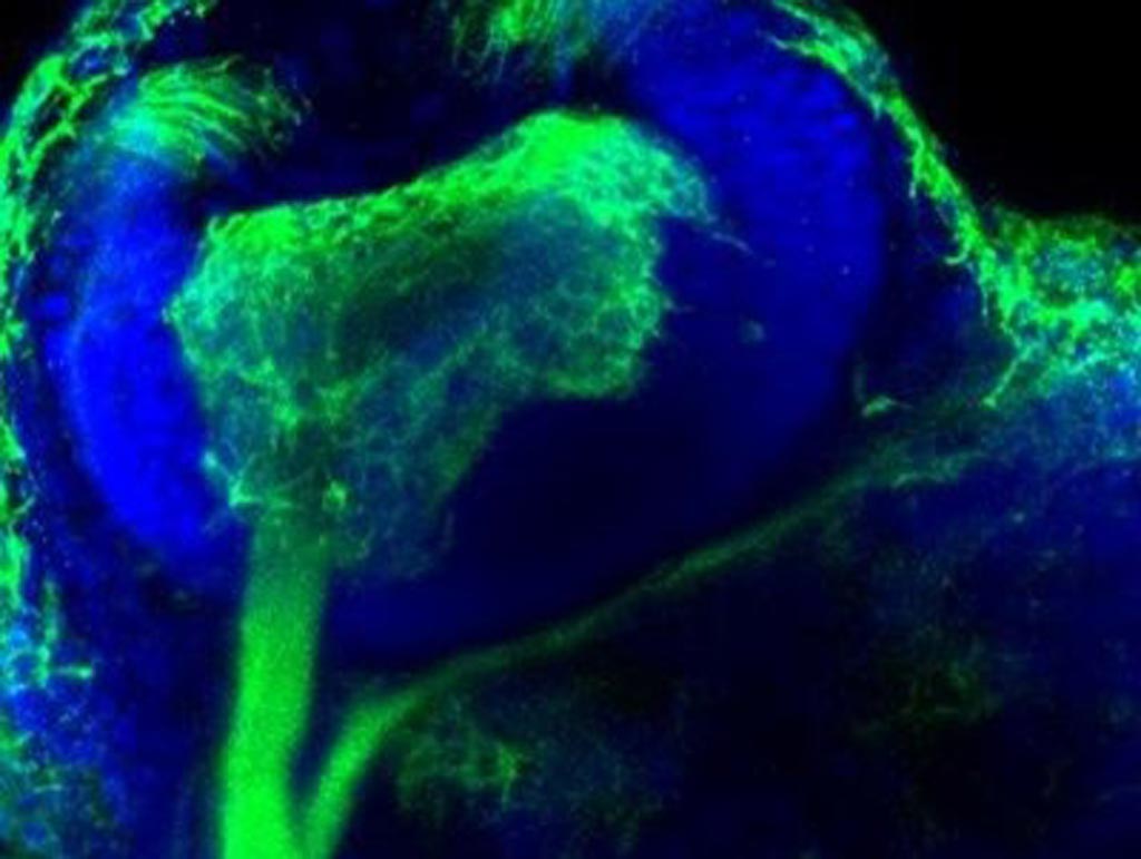 Image: The eye of a zebrafish embryo deficient in NADPH oxidase 2 has an enlarged ganglion cell layer (green) and altered innervation of the brain, which leads to problems with signaling between the eyes and the brain (Photo courtesy of Dr. Daniel Suter, Purdue University).