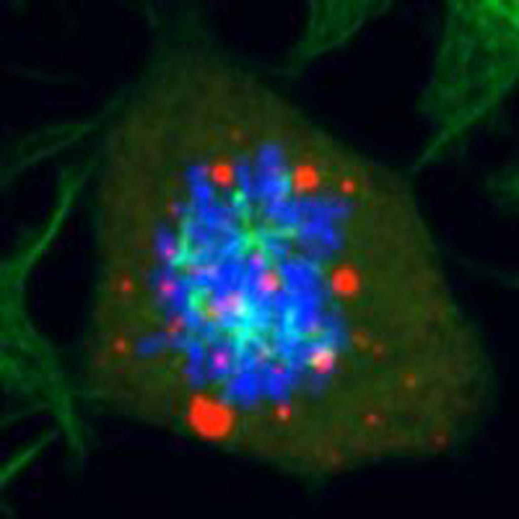 Image: When the enzyme DYRK3 is inhibited, mitotic defects are resulting (red: droplets, green: spindle, blue: DNA) (Photo courtesy of Arpan Rai, University of Zurich).