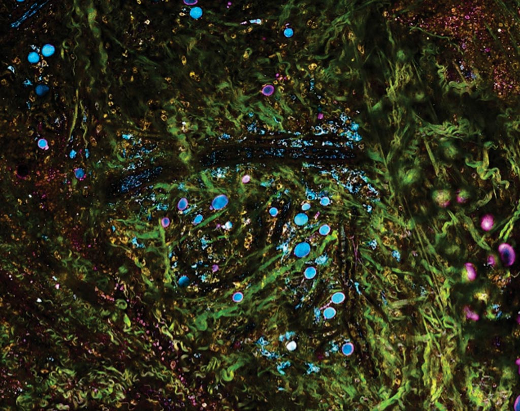 Разработана технология, которая может отображать живые ткани и молекулярные детали в режиме реального времени, позволяя контролировать опухоли и окружающую среду по мере развития рака (фото предоставлено профессором Стивеном Боппартом).