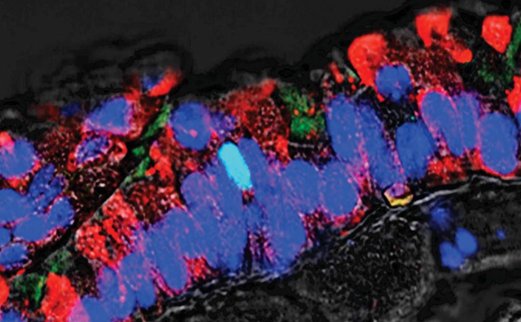 图片：一根支气管，被染成红色和蓝色的细胞是支气管上皮的一部分。这表明其中有一种罕见细胞（染成蓝绿色），应该是一种丛状细胞。科学家发现了起源于这些细胞的一种新型肺癌，它过表达POU2F3这种调节基因的蛋白，有望成为治疗的靶体（图片蒙冷泉港实验室惠赐）。
