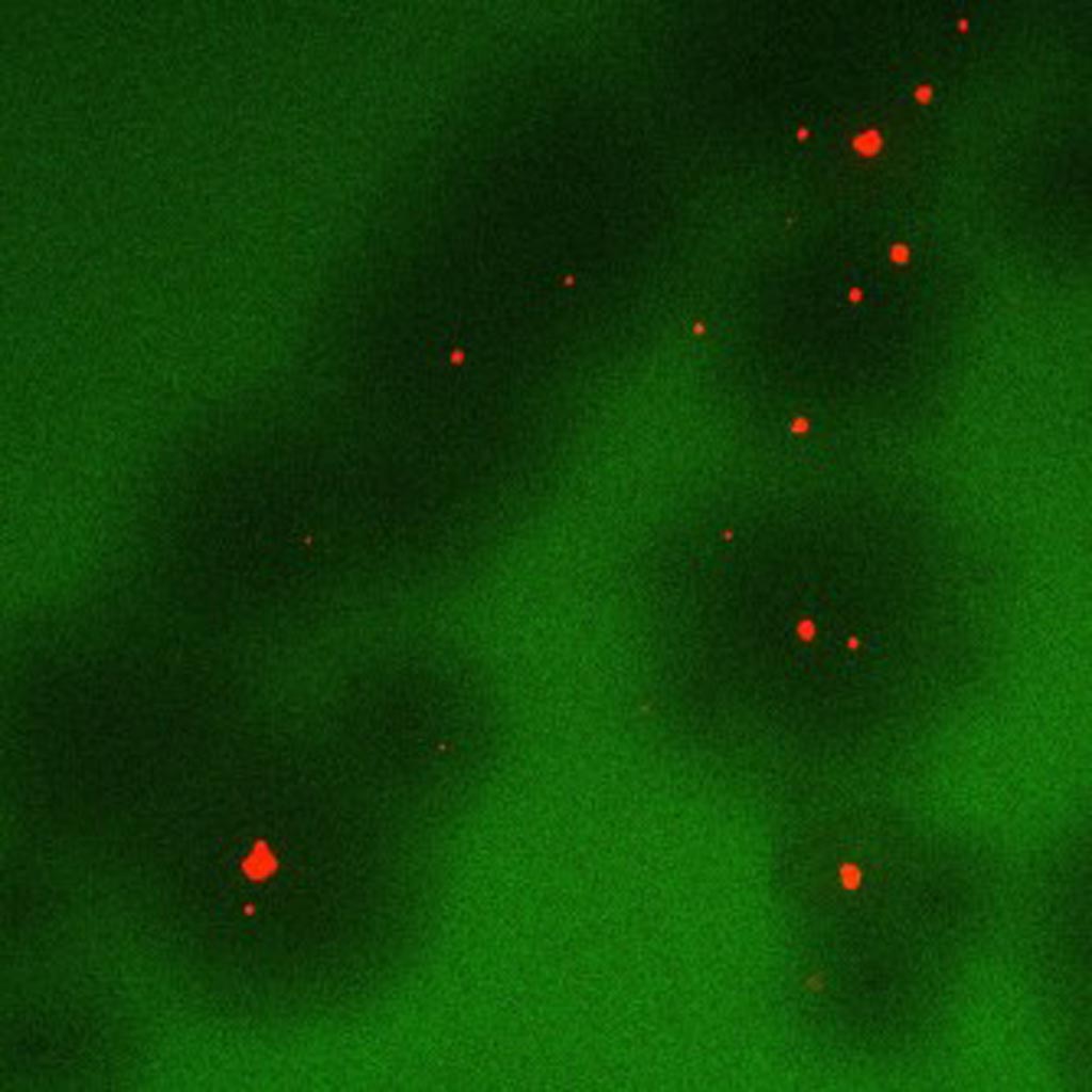 Image: Image shows the effect particles coated with phage (red) have on bacterial colonies (green). The dark green areas around the particles show areas where bacteria are being killed. (Photo courtesy of Rachit Agarwal, Garcia Laboratory, Georgia Institute of Technology).
