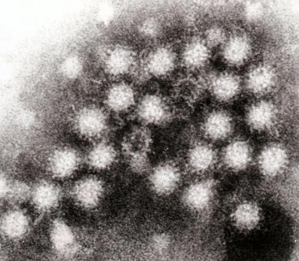 Image: A transmission electron micrograph (TEM) of norovirus particles in feces (Photo courtesy of Wikimedia Commons).