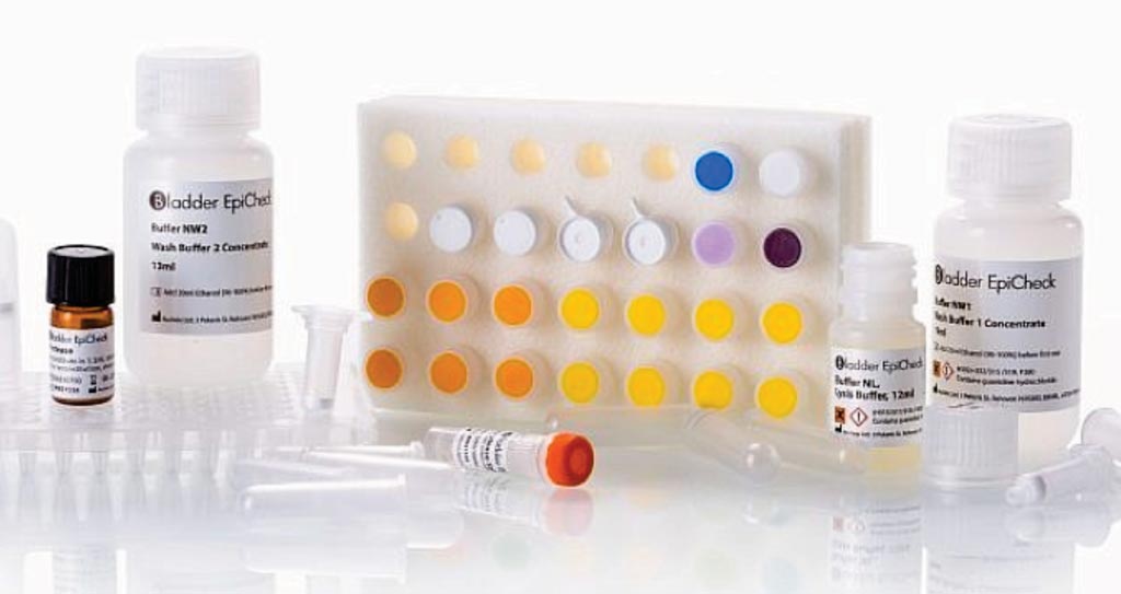 Image: The Bladder EpiCheck diagnostic kit (Photo courtesy of Nucleix).