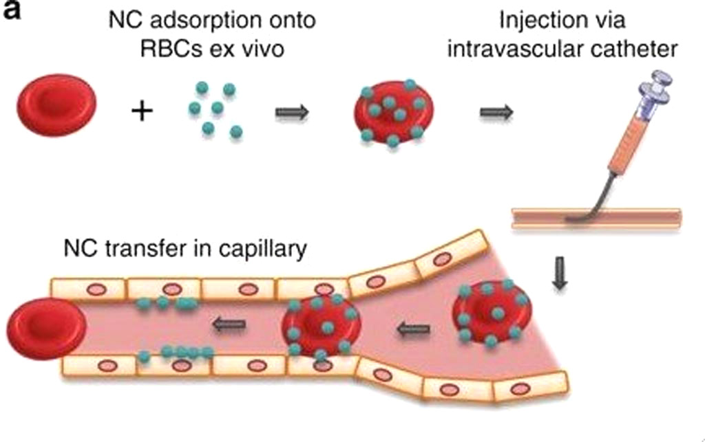 Image: Red blood cells can safely transport nanoscale drug carriers to chosen organs by targeted placement of intravascular catheters (Photo courtesy of the University of Pennsylvania).