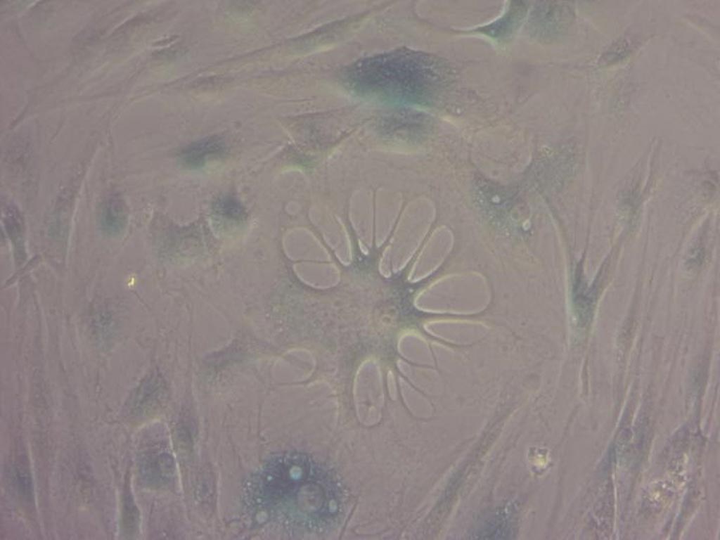 Image: A micrograph showing cellular senescence in human cells (Photo courtesy of Eva Latorre, University of Exeter).