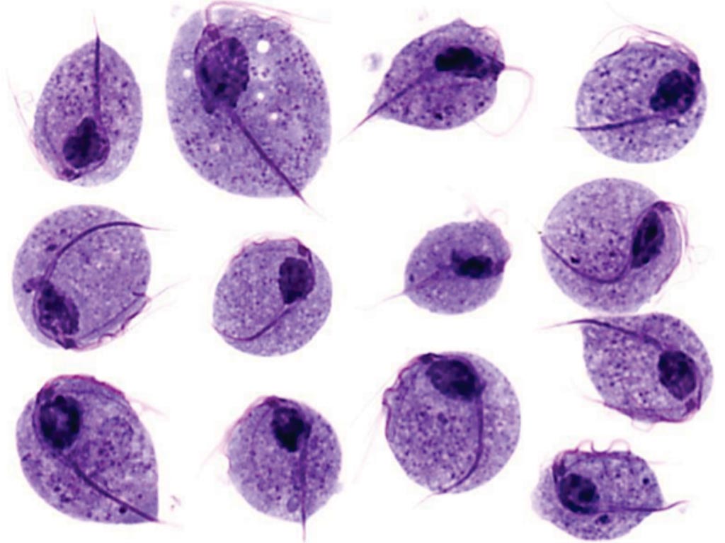 Image: Trichomonas vaginalis protozoan flagellates that cause a common sexually transmitted disease (Photo courtesy of David M. Raymondo).