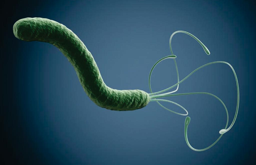 图片：已知螺旋状的幽门螺旋杆菌是定植于人胃的唯一一种细菌。据估计，50%的人肠内隐藏幽门螺旋杆菌，但只有一些人得溃疡或胃癌（图片蒙波士顿大学惠赐）。