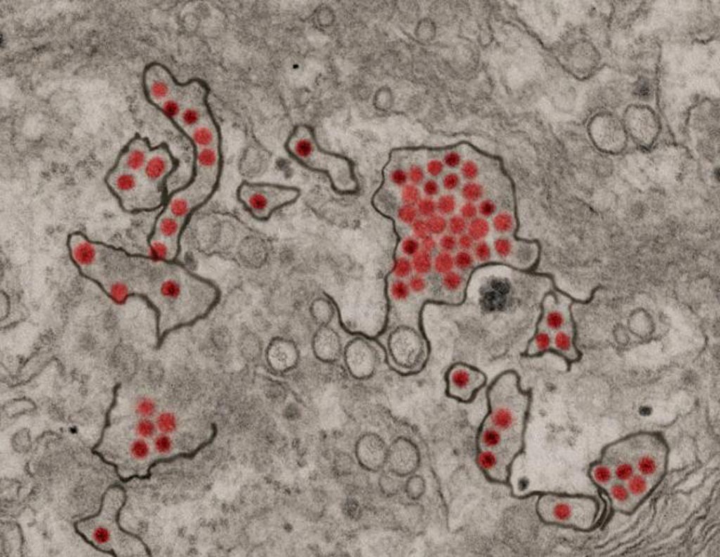 Image: A photomicrograph showing Zika virus particles in red, within the endomembrane system of African green monkey kidney cells (Photo courtesy of the U.S. National Institute of Allergy and Infectious Diseases).