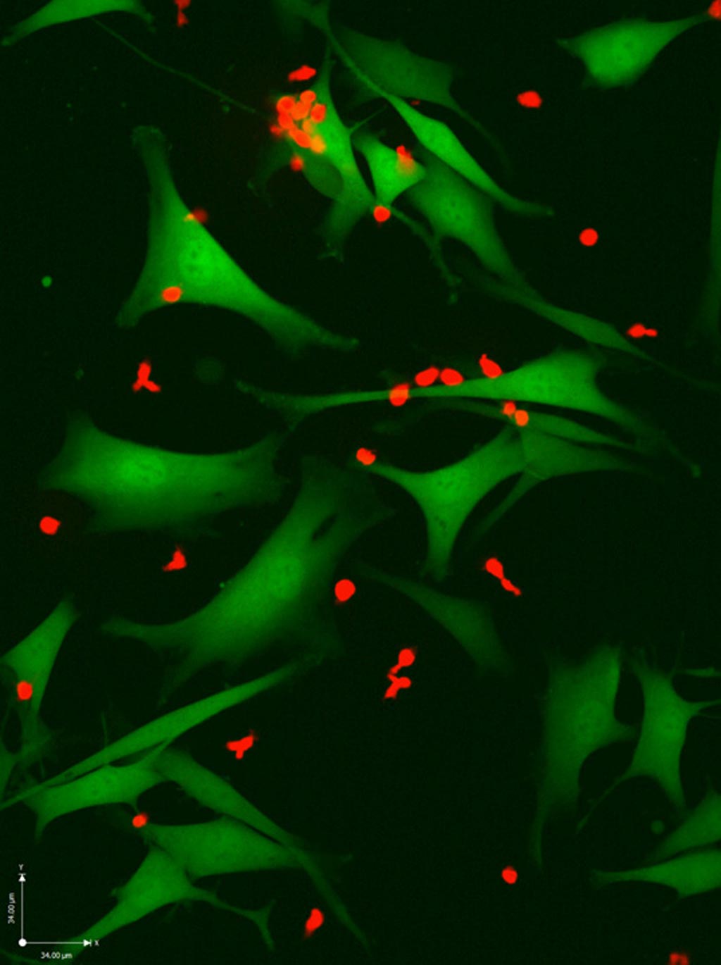 Image: T-cells (red) attacking melanoma cells (green). The neo-antigen-specific T- cells in this image are especially effective at killing cancer cells (Photo courtesy of the Weizmann Institute of Science).