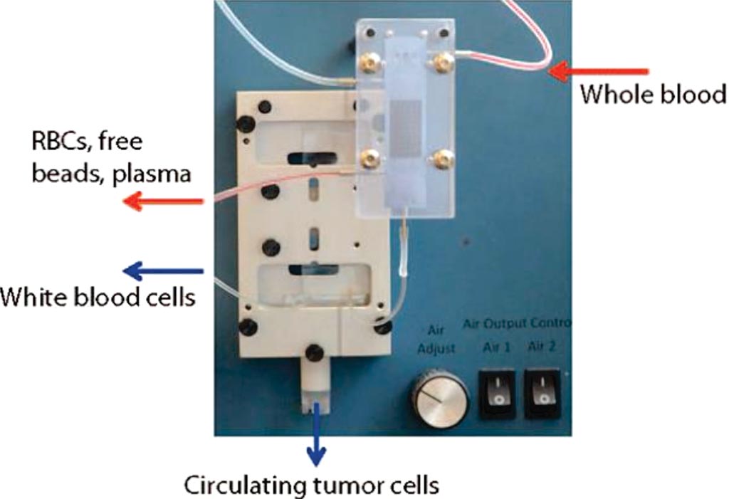 Image: The iChip: The blood sample is passed into the CTC-iChip microfluidic system, which first removes red cells, plasma and free magnetic beads and then sorts out tagged white blood cells, leaving a purified solution of circulating tumor cells (Photo courtesy of Dr. Emre Ӧzkumur, PhD).