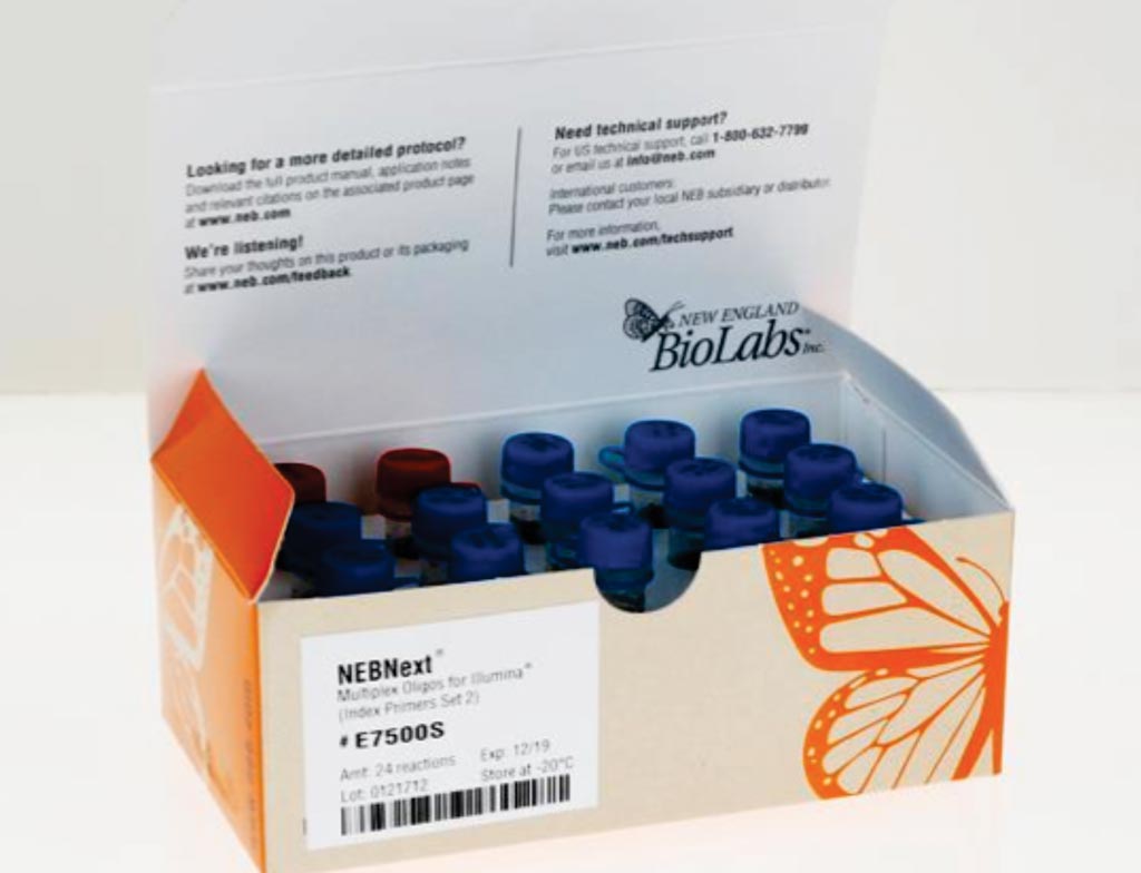 Image: The NEBNext ultra directional RNA library prep kit (Photo courtesy of New England Biolabs).