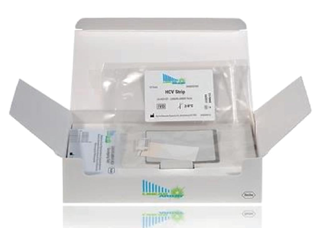 Image: The LINEAR ARRAY HPV Genotyping Test is used for the detection of 37 high- and low-risk human papillomavirus genotypes (Photo courtesy of Roche Diagnostics).
