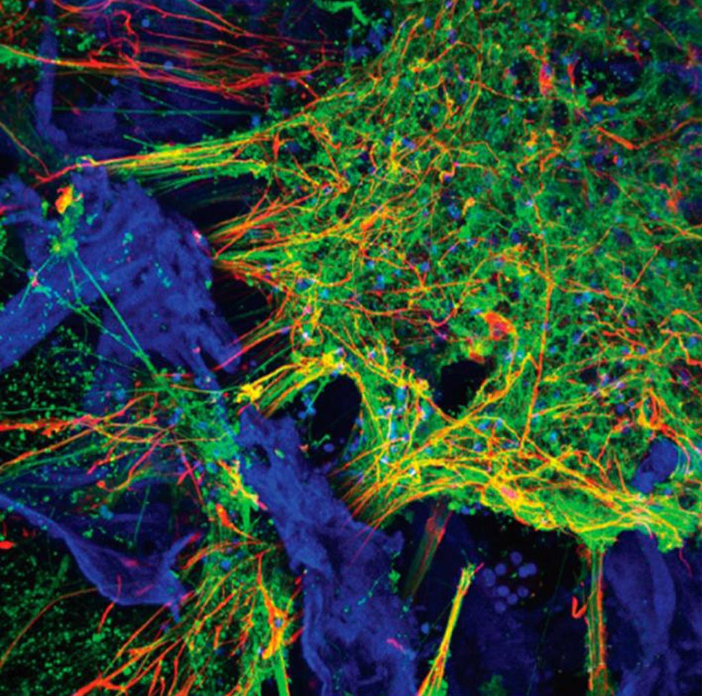 Image: Confocal image of fluorescent markers indicating presence of neurons (green), astrocytes (red) and the silk protein-collagen matrix (blue). Image field is 460 microns (Photo courtesy of Tufts University).