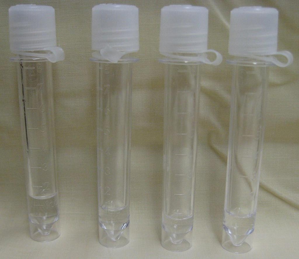 Image: Four vials of human cerebral spinal fluid of normal appearance, collected via lumbar puncture (Photo courtesy of Wikimedia Commons).