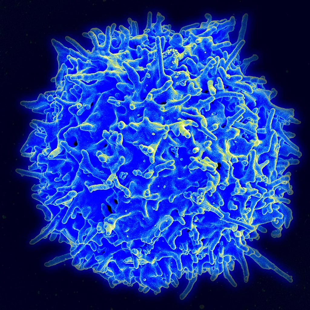 Image: A scanning electron micrograph (SEM) of a human T-cell (Photo courtesy of the U.S. National Institutes of Health).
