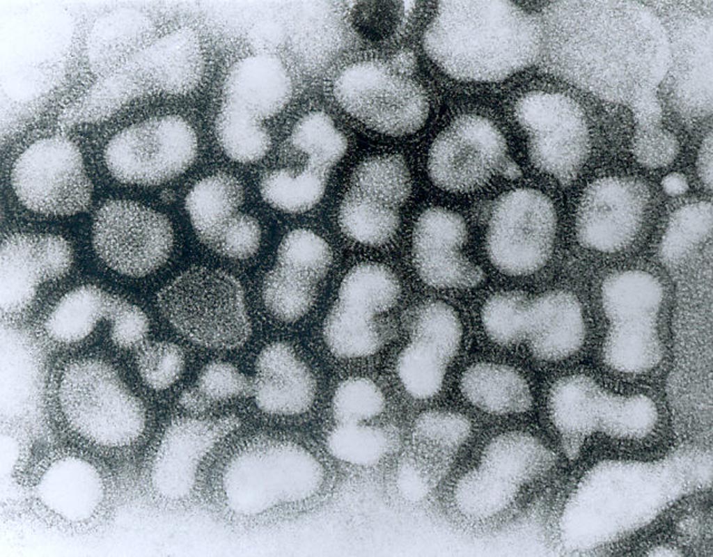 Image: A transmission electron microscopic (TEM) image of influenza A virions in late passage growth phase (Photo courtesy of the CDC).