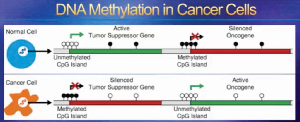 Принцип выявления рака с помощью теста IvyGene на основе анализа метилирования, использующего жидкую биопсию (фото предоставлено доктором Кевином Коннерсом).