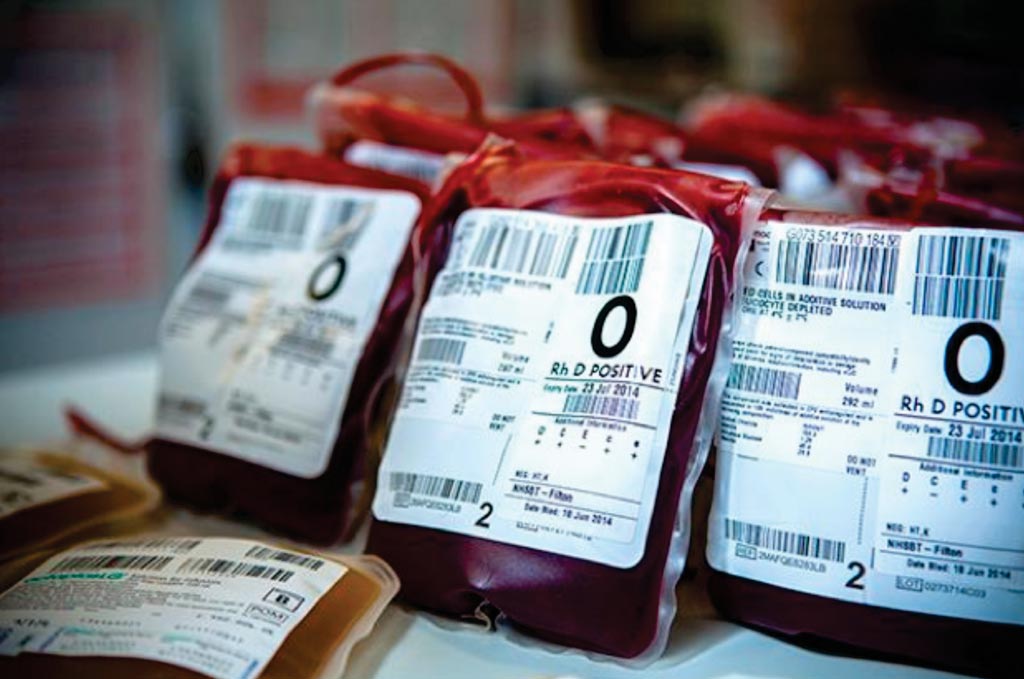 Image: Major trauma victims who receive transfusions of packed blood 22 days old or older may face increased risk of death within 24 hours (Photo courtesy of South West London Pathology).