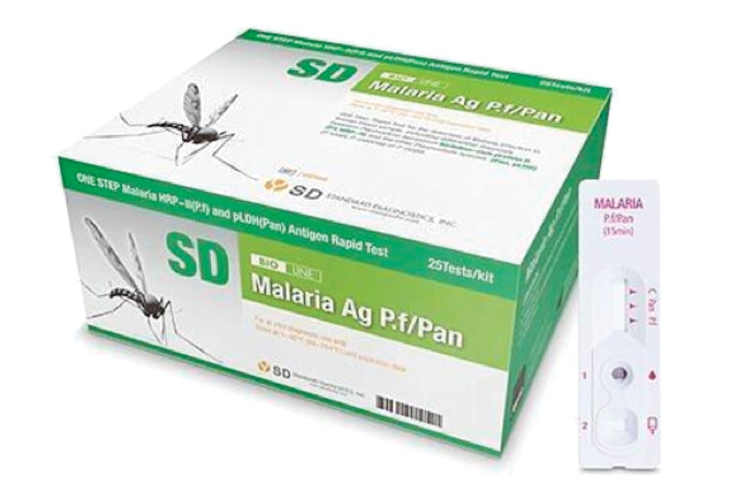 Image: The SD BIOLINE Malaria Ag P.f/Pan test is a rapid, qualitative and differential test for the detection of histidine-rich protein II (HRP-II) antigen of Plasmodium falciparum and common Plasmodium lactate dehydrogenase (pLDH) of Plasmodium species in human whole blood (Photo courtesy of Alere).