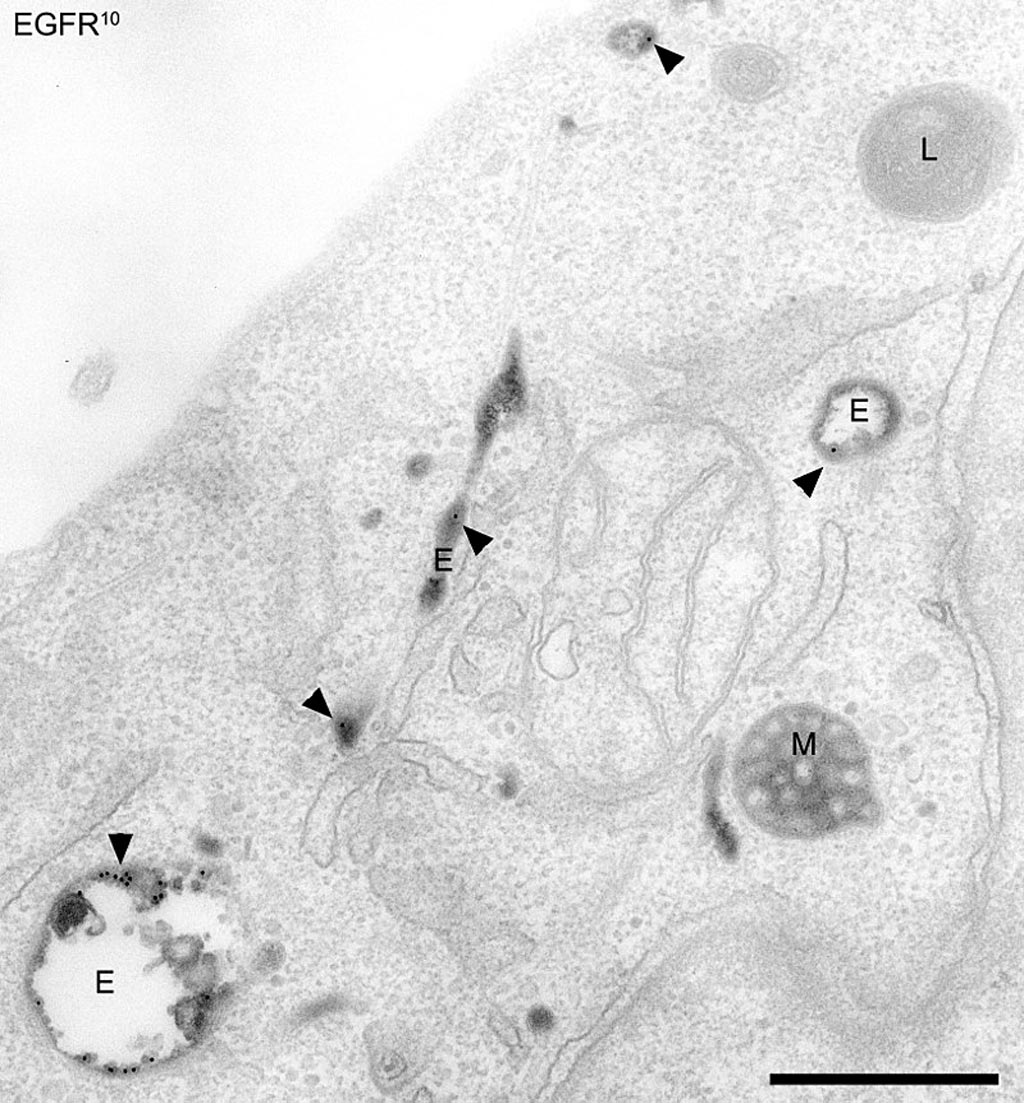 Image: A scanning electron micrograph of endosomes in human HeLa cells - compartments of the endocytic pathway in HeLa cells. Early endosomes (E), late endosomes/MVBs (M), and lysosomes (L) are visible (Photo courtesy of Wikimedia Commons).