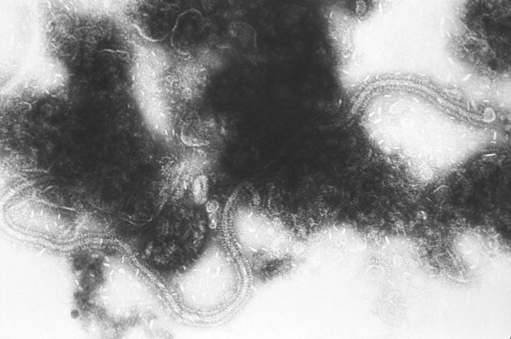 Image: This transmission electron micrograph (TEM) depicts the liberated, chain-like, ribonucleic acid (RNA) genome of the respiratory syncytial virus (RSV) pathogen. RSV is a negative-sense, enveloped RNA virus. The virion is variable in shape and size, with a diameter ranging between 120 and 300 nanometers (Photo courtesy of the CDC).