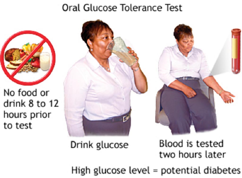Image: During the oral glucose tolerance test (OGTT) blood glucose is tested two hours after drinking 75 grams of glucose, but a test one hour afterwards may be sufficient to diagnose diabetes (Photo courtesy of the US National Institutes of Health).