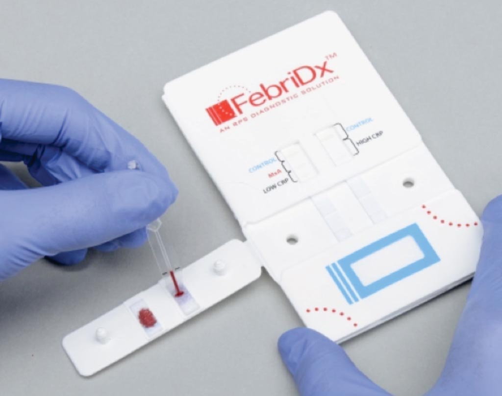 FebriDx за 10 минут предоставляет врачам оценку иммунного ответа организма на острую респираторную инфекцию непосредственно из образца крови из пальца (фото любезно предоставлено RPS Diagnostics).