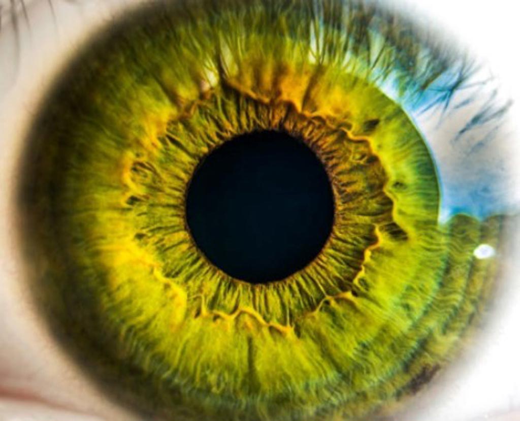 Image: New research marks a crucial step forward in the effort to identify the cause of impaired vision in people around the world. Eyesight problems frequently have a genetic origin, and often a mutation in just a single gene is involved. However, the genetic contribution of many eye-related issues remains poorly understood (Photo courtesy of the IMPC).