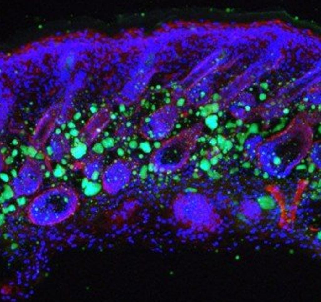 Image: A photomicrograph of the skin showing dermal cells in blue and fat cells in green. The fat cell layer forms the final barrier against bacteria entering deep into the body (Photo courtesy of the University of California, San Diego).