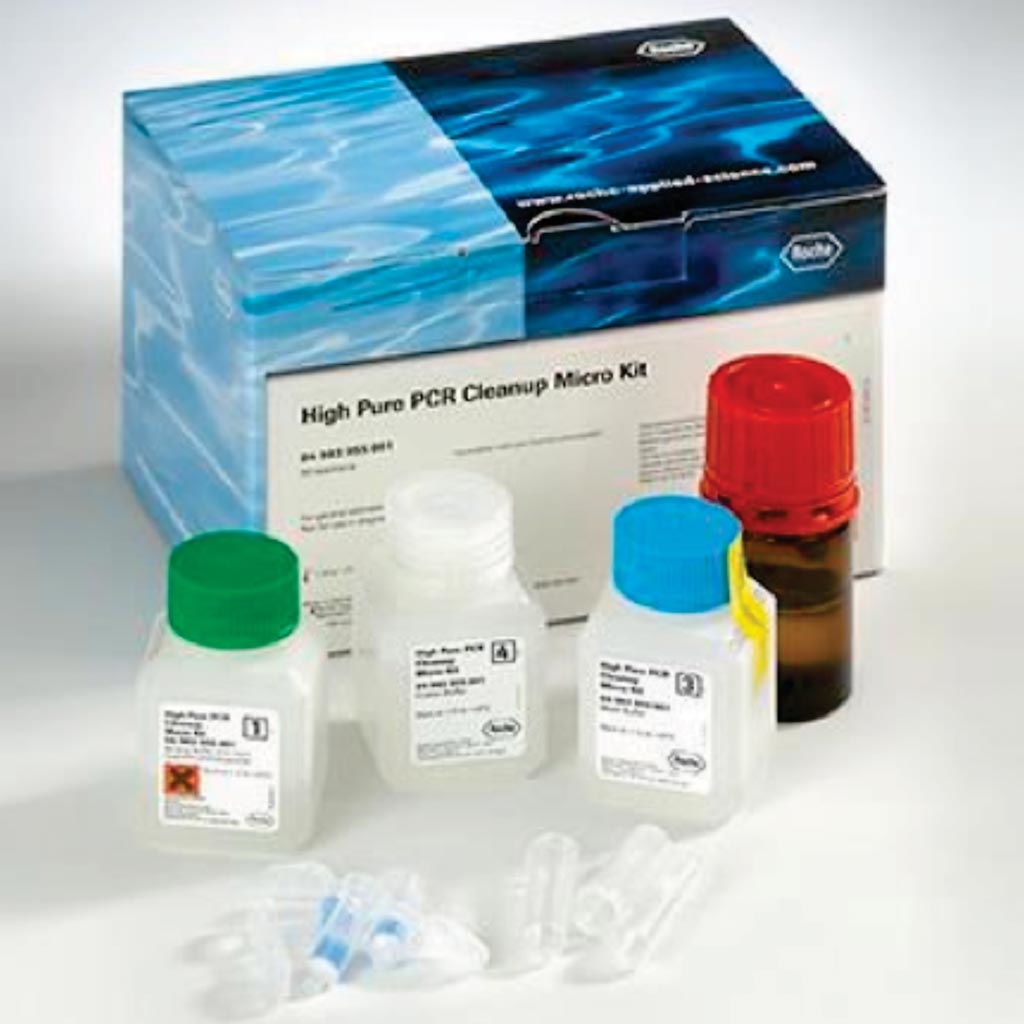 Image: A High Pure PCR template preparation kit (Photo courtesy of Roche Diagnostics).