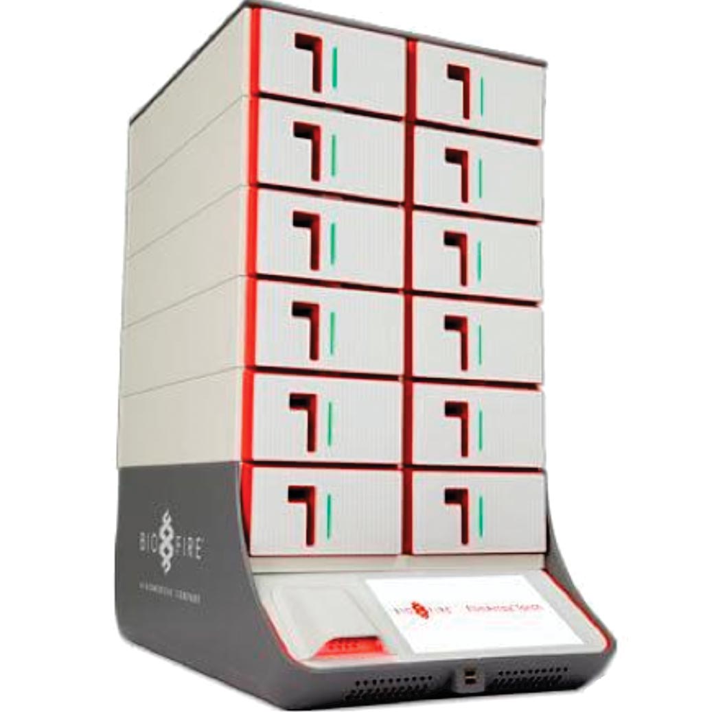 Image: The Biofire FilmArray multiplex RT PCR system enables simultaneous testing for bacteria, viruses, yeast, parasites and/or antimicrobial resistant genes (Photo courtesy of bioMérieux).