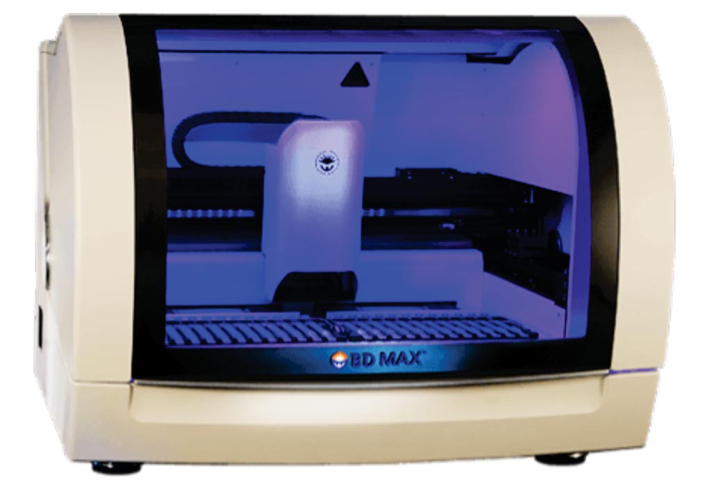 Система BD MAX - это полностью автоматизированная платформа, которая дает возможность консолидировать и стандартизировать широкий спектр молекулярных тестов, включая энтеральную панель BD Max (фото любезно предоставлено Becton Dickinson).