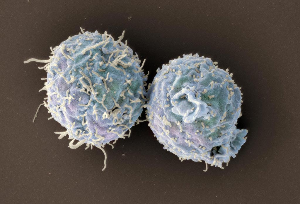 Image: A scanning electron micrograph (SEM) of engineered T-cells lacking coronin 1 (Photo courtesy of the University of Basel).