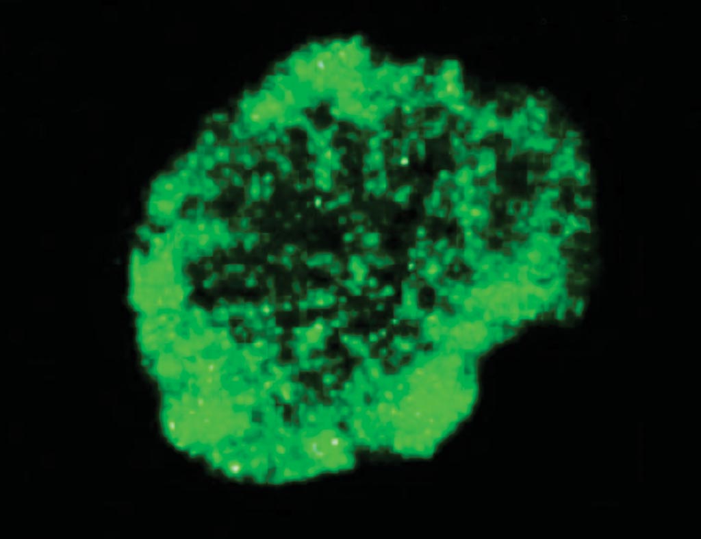 Image: Immunocytochemistry using anti- TRA-1-60 antibody (Photo courtesy of Novus Biologicals).