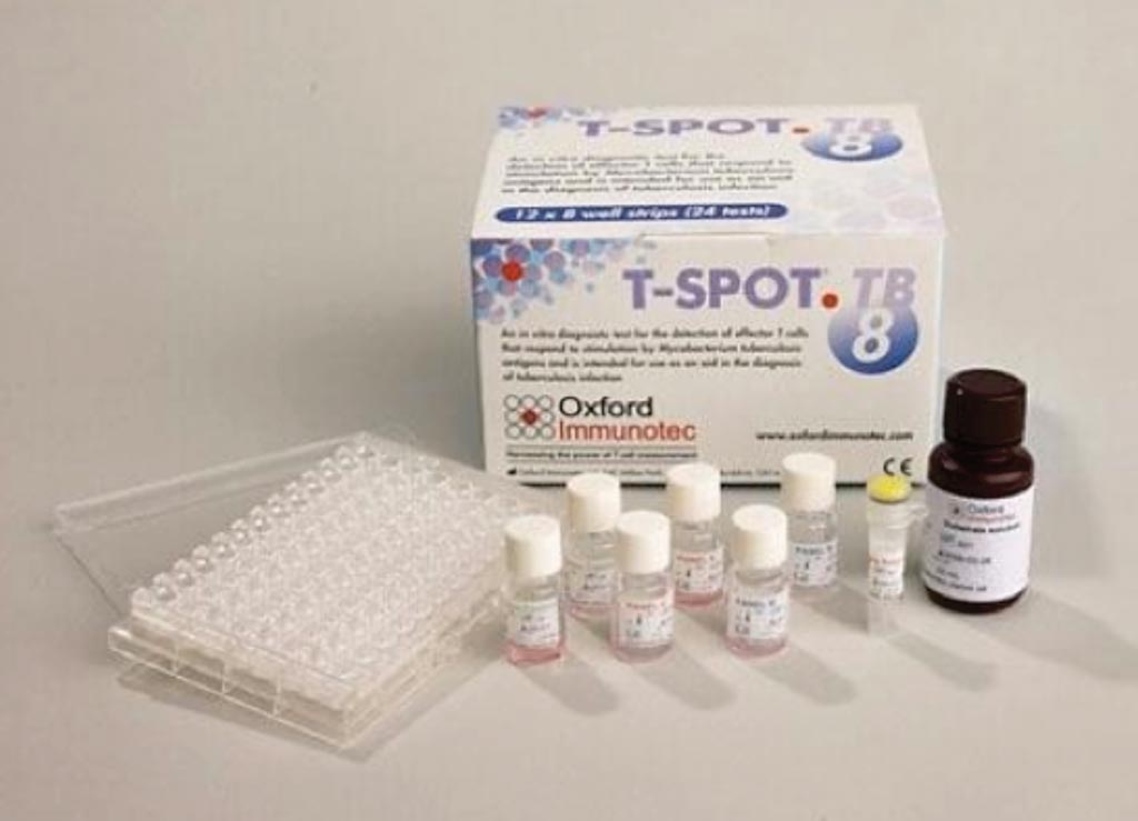 Image: The ELISpot TB diagnostic test kit for tuberculosis (Photo courtesy of Oxford Immunotec).