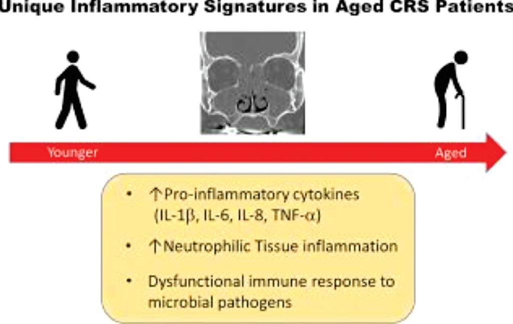 Image: Chronic rhinosinusitis (CRS) in elderly patients is associated with an exaggerated neutrophilic proinflammatory response to pathogenic bacteria (Photo courtesy of Vanderbilt University Medical Center).