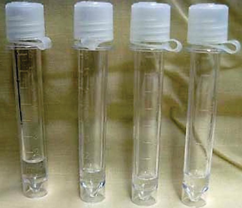 Image: Vials of cerebrospinal fluid that can be sequenced for cell-free DNA in glioma patients (Photo courtesy of James Heilman, MD).