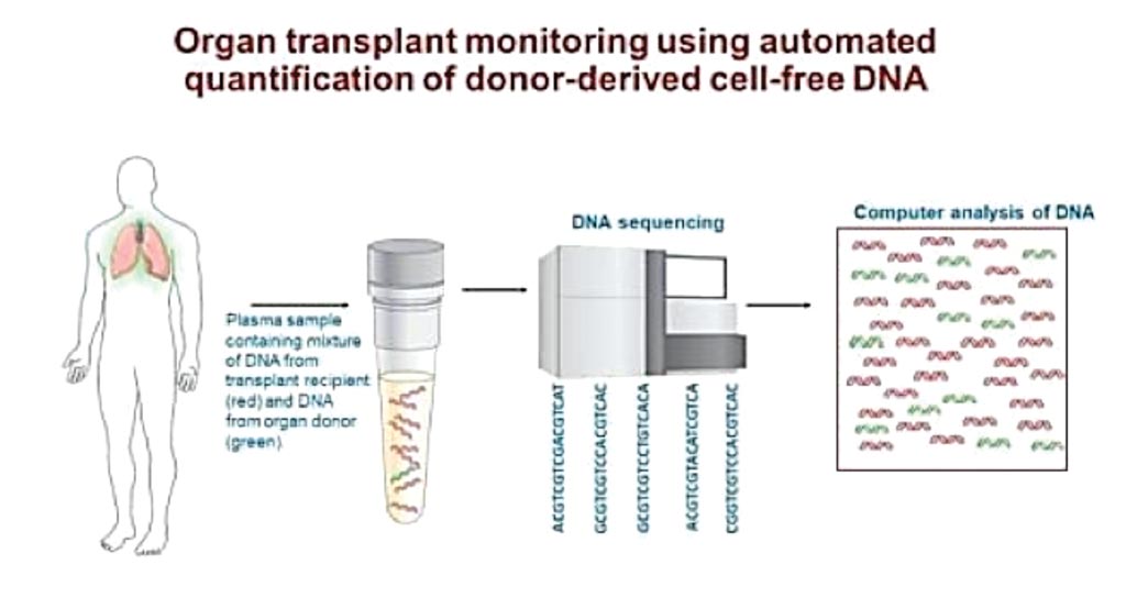 Анализ крови для мониторинга трансплантации органов с использованием секвенирования ДНК (фото любезно предоставлено Национальным институтом болезней сердца, легких и крови).