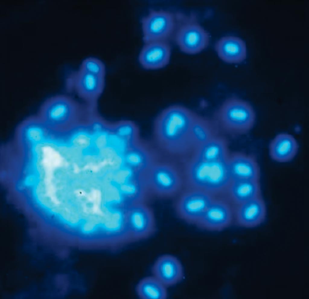 Image: Microsporidian spores stained Calcofluor White M2R (Photo courtesy of Institute Pasteur of Tunis).
