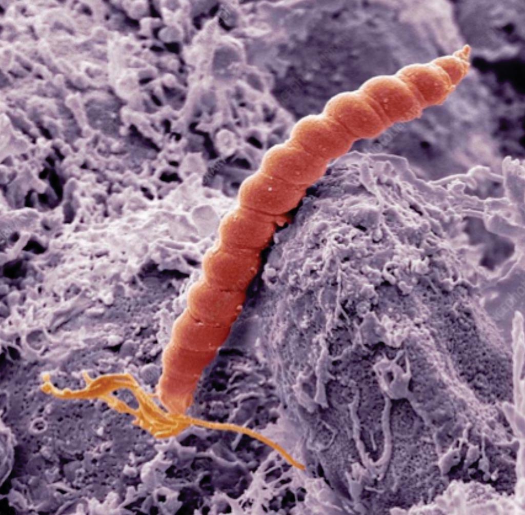 Image: A colored scanning electron micrograph (SEM) of a Helicobacter pylori bacterium (red) in the stomach (Photo courtesy of Steve Gschmeissner / SPL).