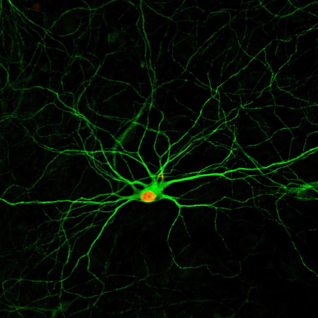 Image: A simple treatment using four small molecules converts human astrocytes - a common type of cells in the nervous system - into new neurons, which develop complex structures after four months (Photo courtesy of the Gong Chen Laboratory, Pennsylvania State University).