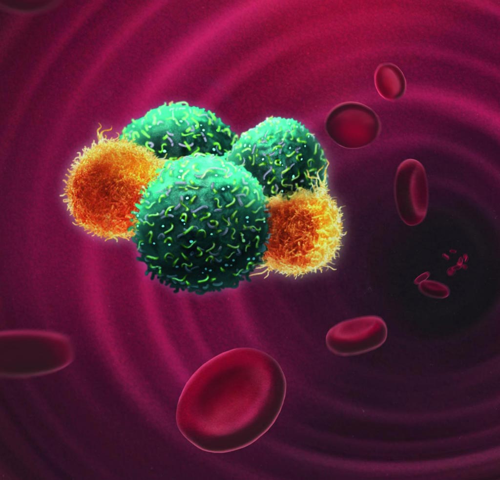 Image: An artistic representation of circulating tumor cells traveling in the bloodstream escorted by neutrophils. Through this interaction, neutrophils are able to enhance the metastatic ability of circulating tumor cells (Photo courtesy of the University of Basel).