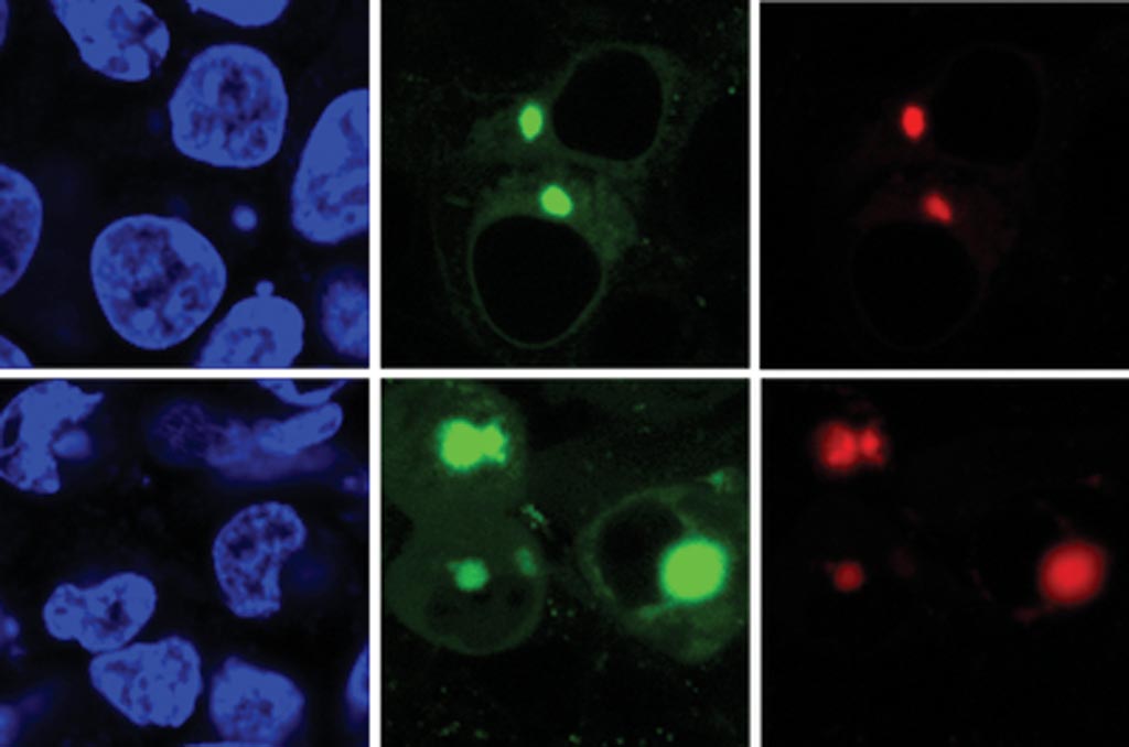 Image: The new AggTag method allows researchers to see the previously undetectable but potentially disease-causing intermediate forms of proteins as they misfold. The method uses fluorescence to simultaneously detect two different proteins (red, green) within the cell (blue) (Photo courtesy of the Zhang Laboratory, Pennsylvania State University).