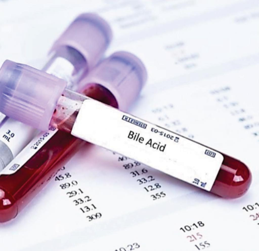 Image: The bile acid blood test is used to predict stillbirth risk (Photo courtesy of bluehorizon).