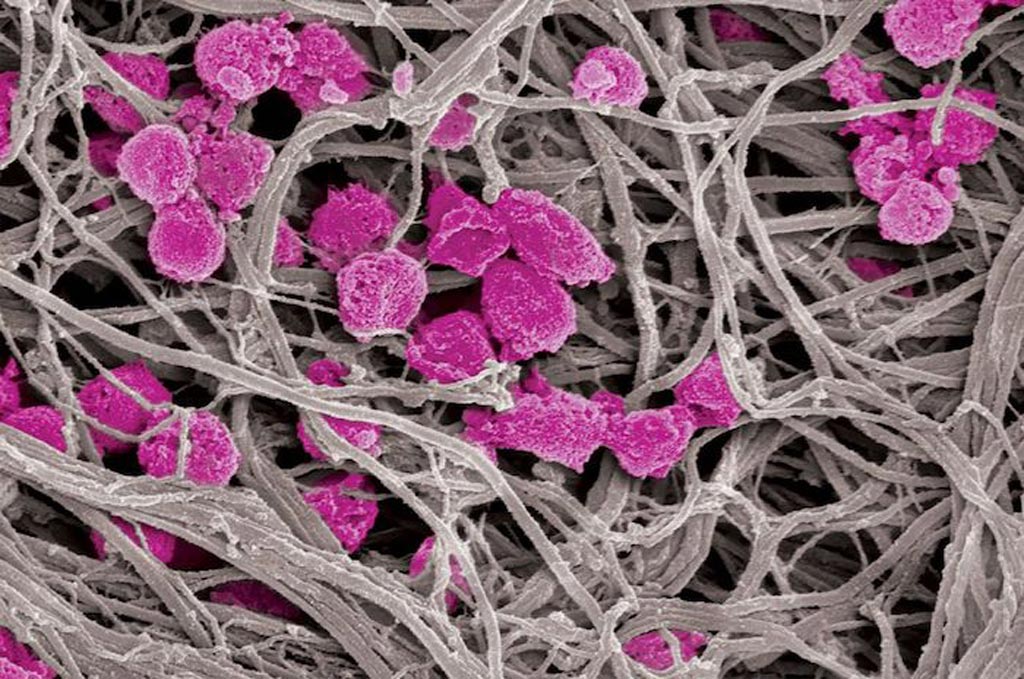 Image: Platelet decoys (pink), unlike normal platelets, are not activated by collagen fibers (gray), making them an attractive option for antithrombotic and cancer treatment (Photo courtesy of Harvard University).